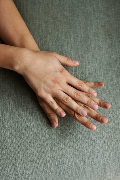 Как справиться с проблемой ломких ногтей
