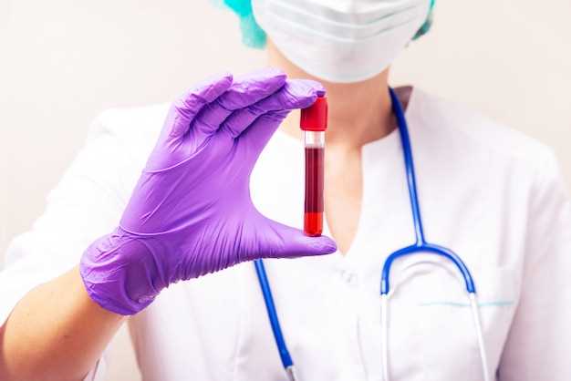Как проводится анализ крови на все показатели?