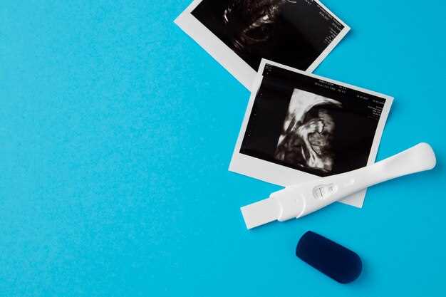 Узи на 27-32 неделе беременности: подтверждение пола ребенка