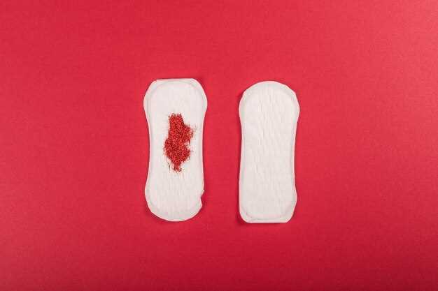 Кровь при мочеиспускании у женщин: кровяные выделения, сгустки крови - лечение