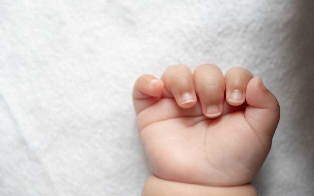 Как предотвратить появление белых пятен на ногтях у детей