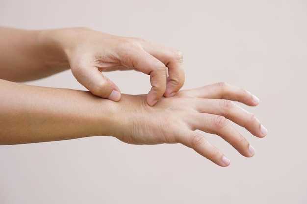 Причины отслаивания кожи на пальцах