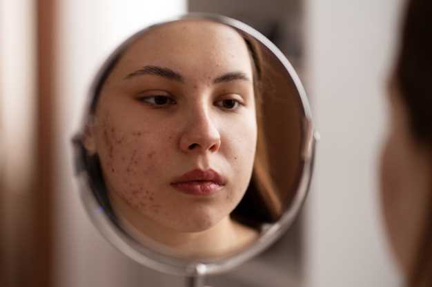 Сыпь на лице: причины и лечение