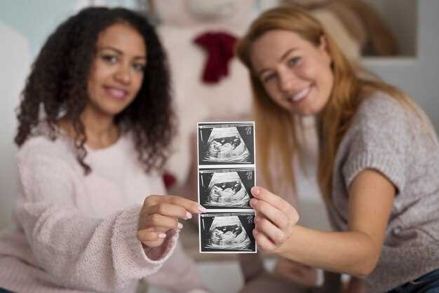 Информация о проведении УЗИ во время беременности